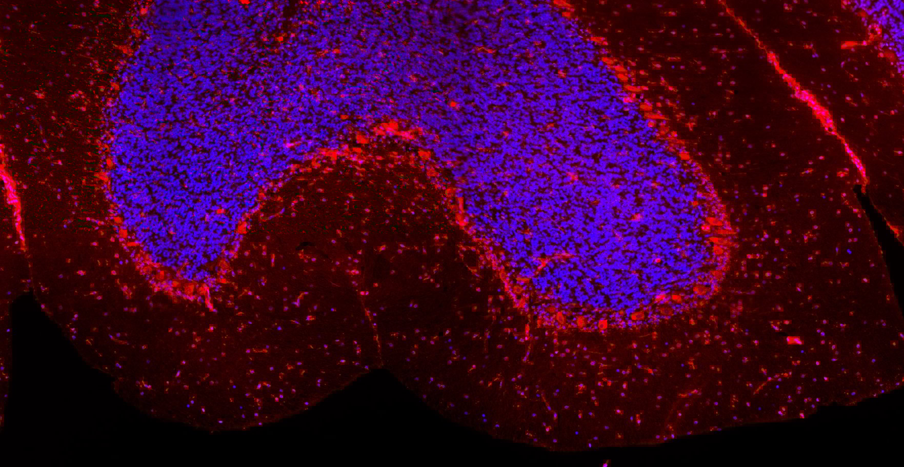  RNATx block Chantal, Julia, Coverart tiles.lif - 5ezoom1_Merging_001 (RGB).jpg