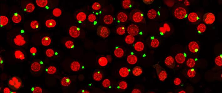 Inflammasomes Inflammasomes