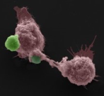 Routine SEM Two macrophages (purple) with GeRPs (green)