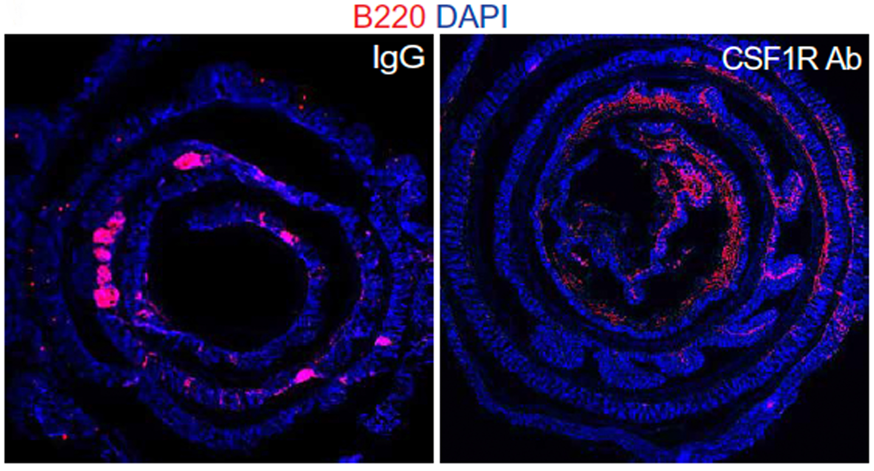 Tertiary Lymphoid Structures (TLS) in Mice Colon