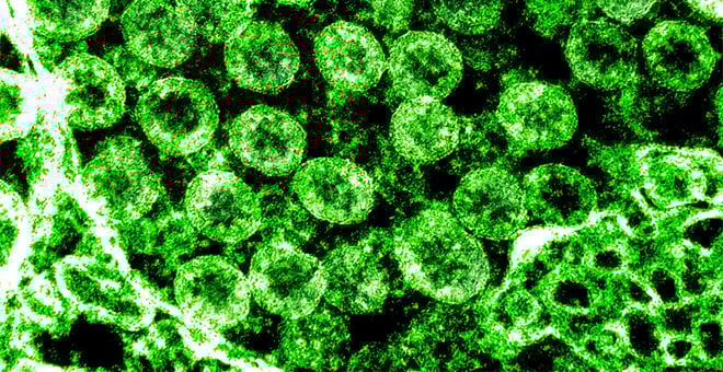 Telegram: Robert Finberg explains UMass Medical School role in promising COVID-19 drug trial