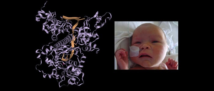  On the left, a three-dimensional structure of the protein DIS3L2 in purple interacting with RNA in orange; on the right, a photo of a newborn in the hospital.