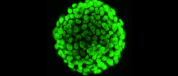  A ball of cells glowing fluorescent green.
