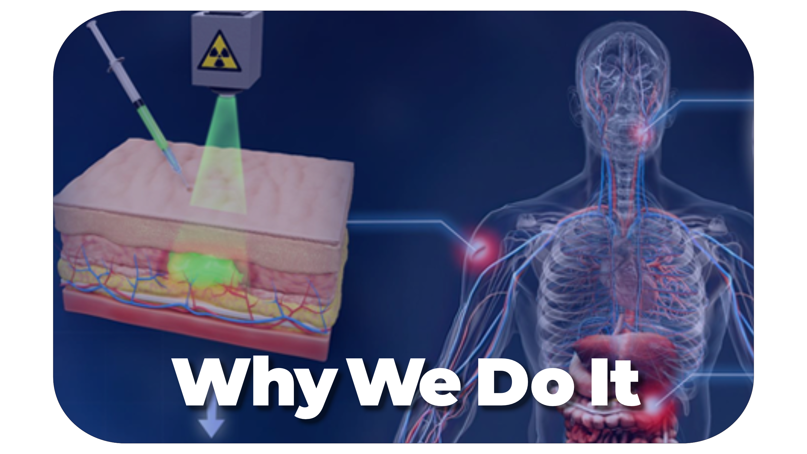  han_Why We Do It_rightfont.png