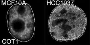 loss-peripheral-heterochromatin loss-peripheral-heterochromatin