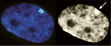 Xist RNA Panel Xist RNA Panel