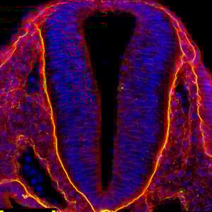  research-neural-tube.jpg