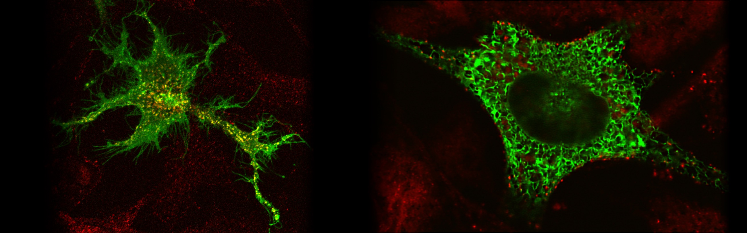 microscope images of two cells stained with red and green fluorescent markers