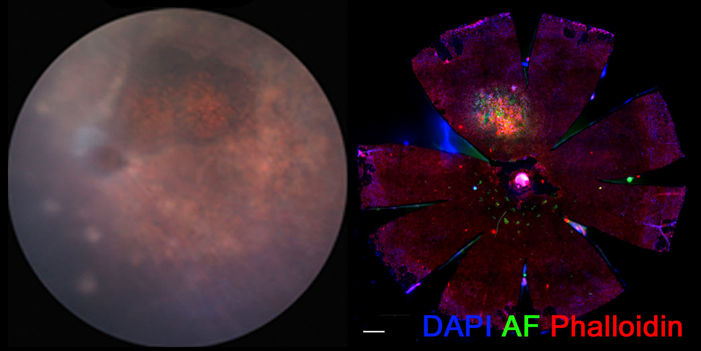 Altered photoreceptor metabolism in mouse causes late stage age-related macular degeneration pathologies.