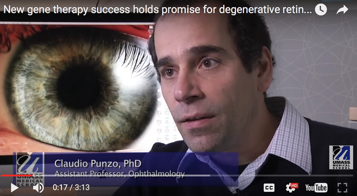 UMass Chan experts: New gene therapy success holds promise for retinal diseases