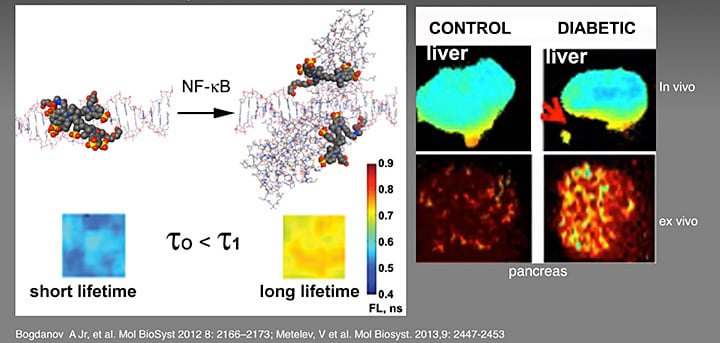 Molecular Fluorescence Lifetime Imaging Sensor of Pro-inflammatory Signaling in Diabetes Molecular Fluorescence Lifetime Imaging Sensor of Pro-inflammatory Signaling in Diabetes