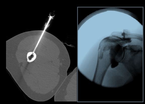 UMass Chan Radiology - MSK Fellowship Program Goals UMass Chan Radiology - MSK Fellowship Program Goals