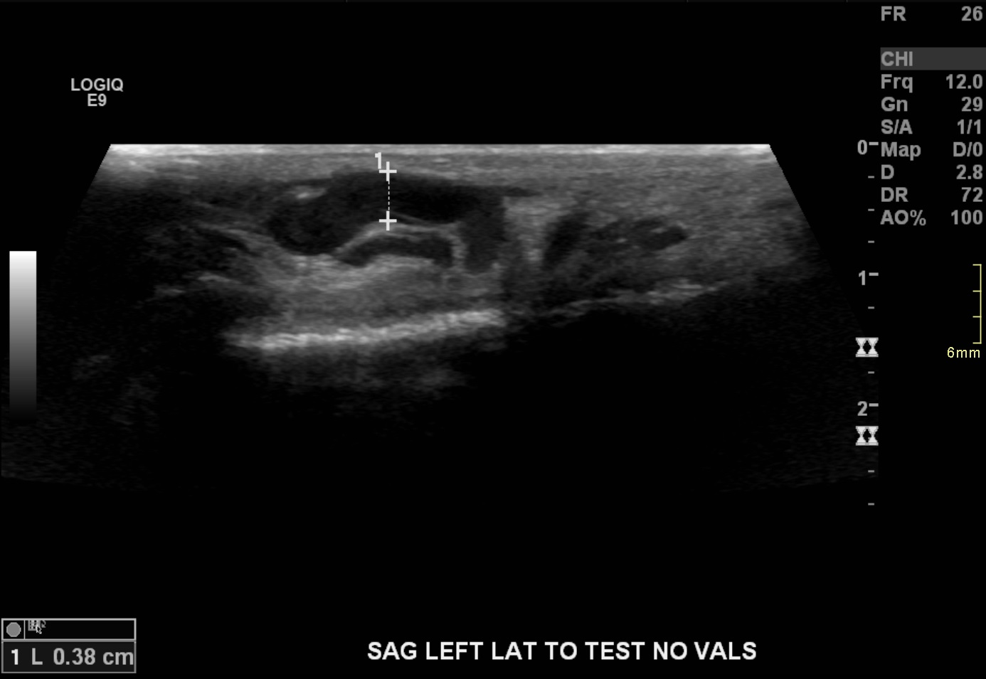 Ultrasound1 Ultrasound1