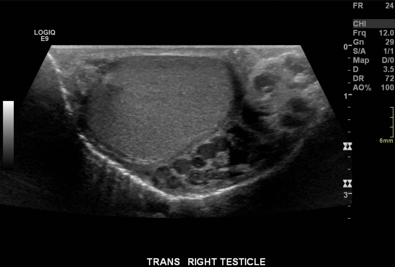 Ultrasound1 Ultrasound1