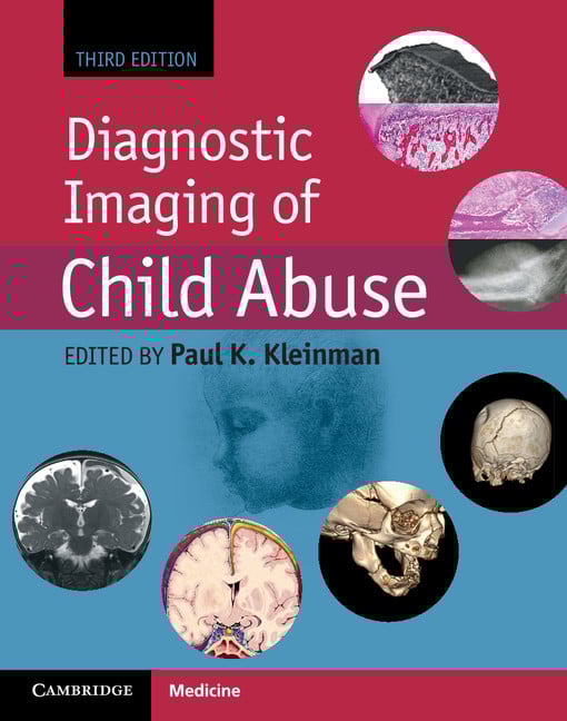 Diagnostic Imaging of Child Abuse 3rd Edition