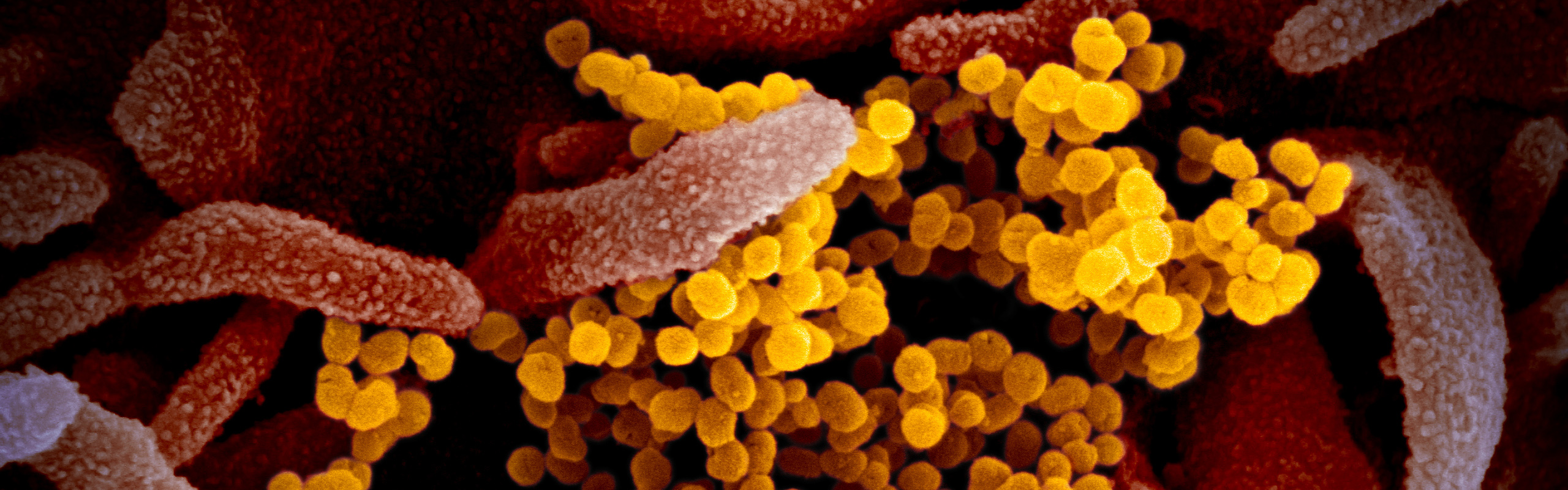 1600x500 slider SARS.jpg