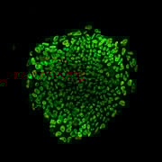 Transgenic Animal Modeling