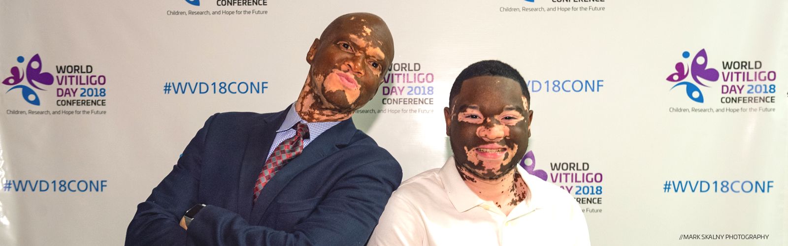 World Vitiligo Day 2018 Conference